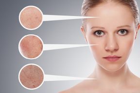 Các cách trị da mặt khô bong tróc vào mùa đông tại nhà chưa bao giờ hết hot