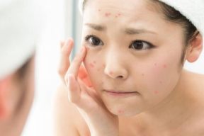 3 thủ thuật trước khi đi ngủ giúp đẹp da, giảm mụn