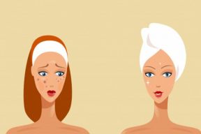 6 Cách chăm sóc da mụn từ lời khuyên của các chuyên gia