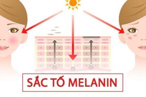 Melanin là gì? Cơ chế hình thành sắc tố melanin gây nám da