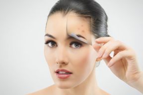 NGUYÊN NHÂN VÀ GIẢI PHÁP GIẢM MỤN VÙNG TRÁN